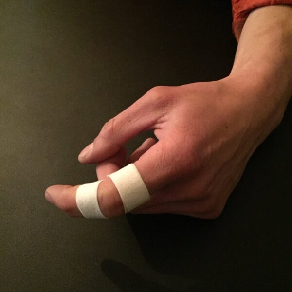 Hình ảnh bị đứt tay troll một ngón hai chỗ