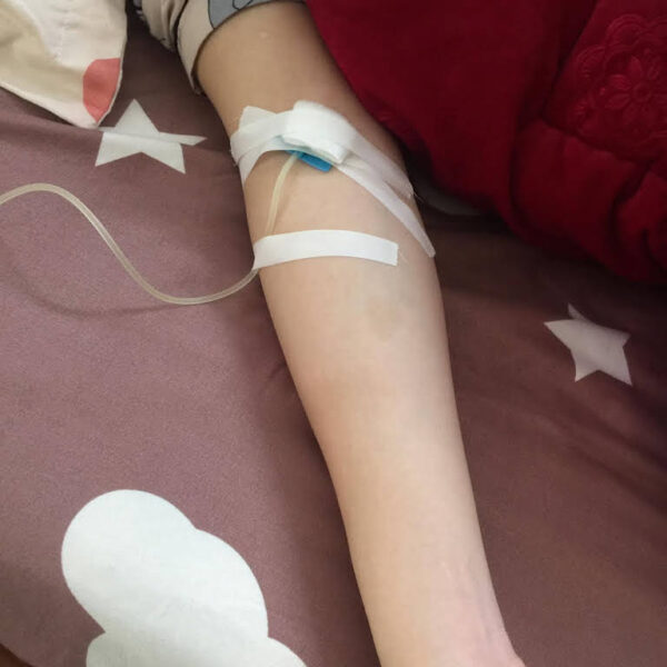 Ảnh truyền nước ở tay nữ Tại Nhà