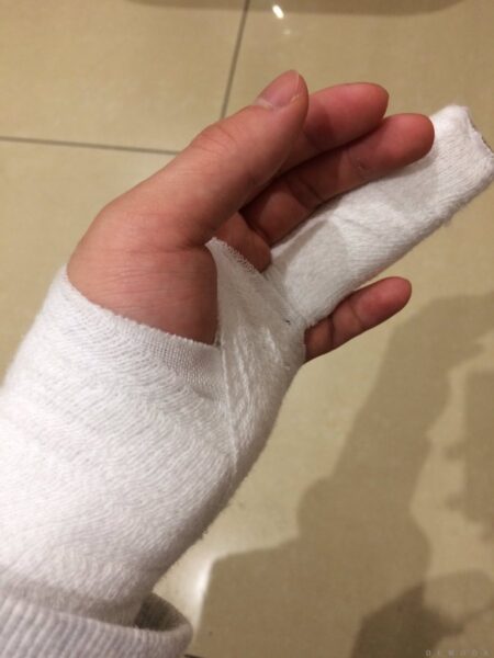 Hình Ảnh đứt tay troll người yêu đẹp nhất